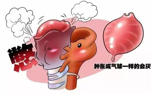 “咽喉疼”真的会“要命”吗?—— 急性会厌炎 - 科普宣传 - 贵黔国际医院